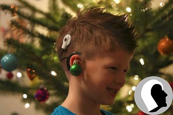 CI Kopf 2018 männlich Kind